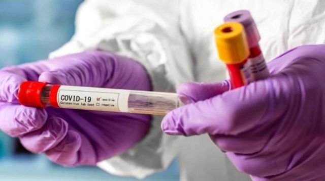 Життя забрав COVID-19: за тиждень у Запорізькій області підтверджено 405 випадків коронавірусу