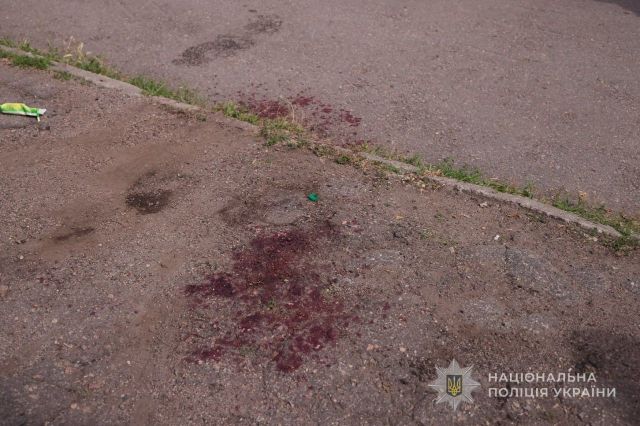 Раптово напав на правоохоронців: поранений нападник помер, троє запорізьких поліцейських у лікарні