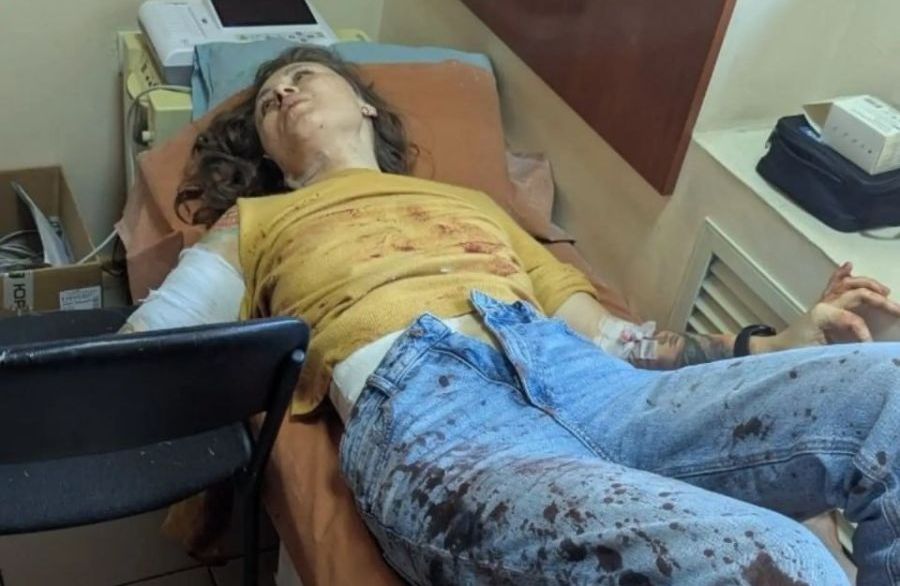 «Бачу скло, рука висить, капає кров»: у Запоріжжі під час ворожого удару по греблі Дніпрогесу поранення отримала майстриня